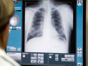 DR X Ray