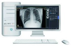 Digital radiography, DR, transportable, upgrade