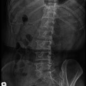 x ray image one