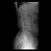 x ray image two